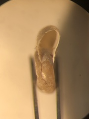 Gyraulus