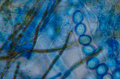 Lamprospora retispora