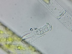 Vaginicolidae