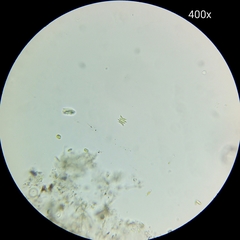 Tetradesmus