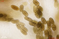 Thyronectroidea chrysogramma