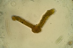 Schistidium frigidum