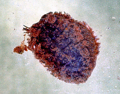 Acanthochitona crinita