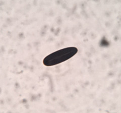 Hypoxylon fuscopurpureum