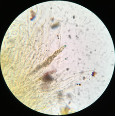 Hypoxylon fuscopurpureum