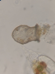 Codonella cratera