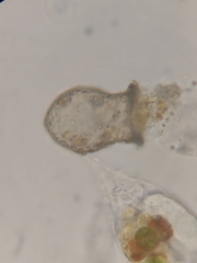 Codonella cratera