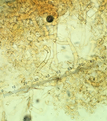 Botryobasidium vagum
