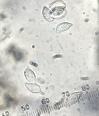 Botryobasidium vagum