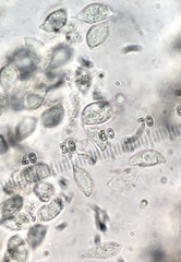 Botryobasidium vagum