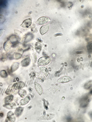 Botryobasidium vagum