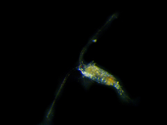 Centropages abdominalis