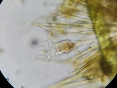 Collotheca