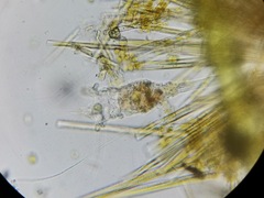 Collotheca