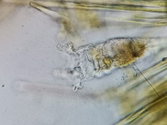 Collotheca