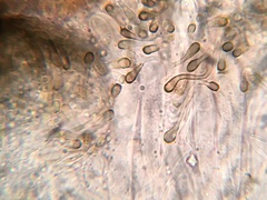 Durella melanochlora