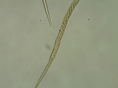 Trichia crateriformis