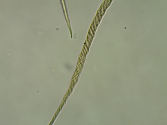 Trichia crateriformis