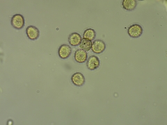 Trichia crateriformis