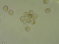 Trichia crateriformis