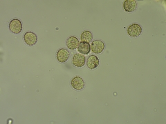 Trichia crateriformis