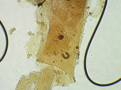 Trichia crateriformis
