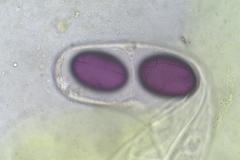 Ascobolus immersus
