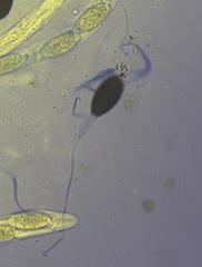 Podospora anserina