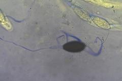 Podospora anserina