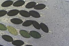 Podospora anserina