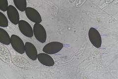 Podospora anserina