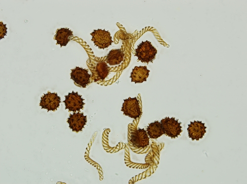 Fossombronia caespitiformis image
