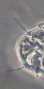 Echiniscidae
