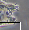 Echiniscidae