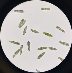 Isopterygiopsis muelleriana