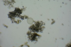 Coelosphaerium