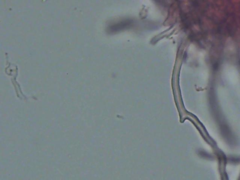 Butyrea luteoalba