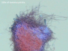 Butyrea luteoalba