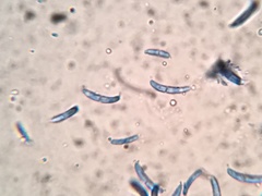 Pseudolachnea hispidula