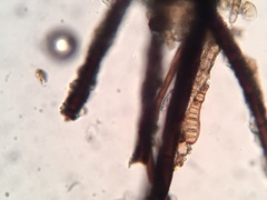 Helminthosporium velutinum