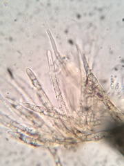 Lachnellula ellisiana