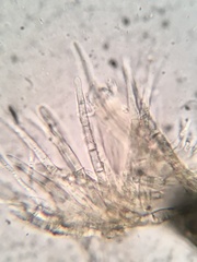 Lachnellula ellisiana