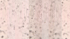 Lachnellula ellisiana