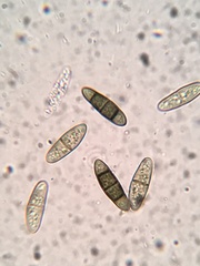 Hysterium angustatum