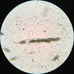 Hysterium angustatum