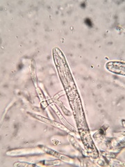 Lachnellula ellisiana