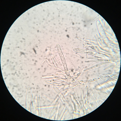 Lachnellula ellisiana