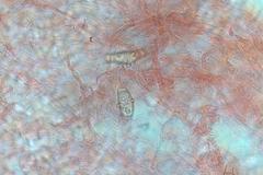 Asterophora mirabilis