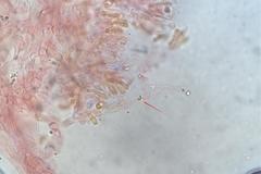 Asterophora mirabilis