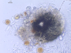 Sphaerellopsis filum